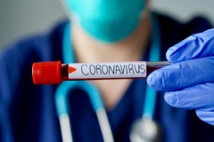 28 maja: raport w sprawie koronawirusa