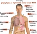 Plaga zachorowań na świńską grypę na Dolnym Śląsku - przypadek również w Chojnowie